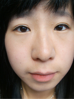 에코라인 이미지